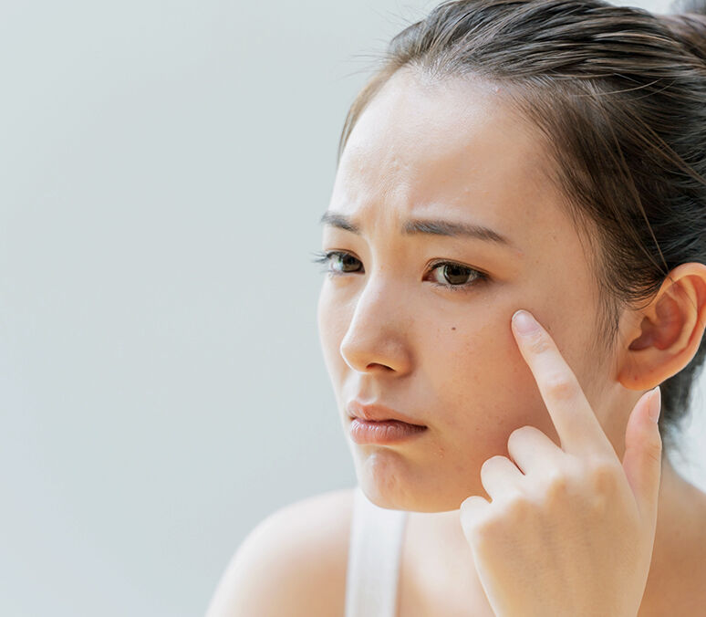 The_sensitive-skin-experts_2 